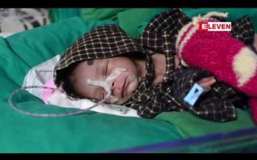 Embedded thumbnail for အိန္ဒိယတွင်အရှင်လတ်လတ်မြေမြှုပ်ခံခဲ့ရသည့်မွေးကင်းစကလေးအံ့ဖွယ်အသက်ရှင်နေမှုကို ဆရာဝန်တွေအံ့သြ (ရုပ်သံ)