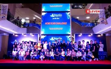 Embedded thumbnail for " Acne Scar Challenge နောက်ဆုံးအဆင့် ဇကာတင်ရွေးချယ်ပွဲကြီး