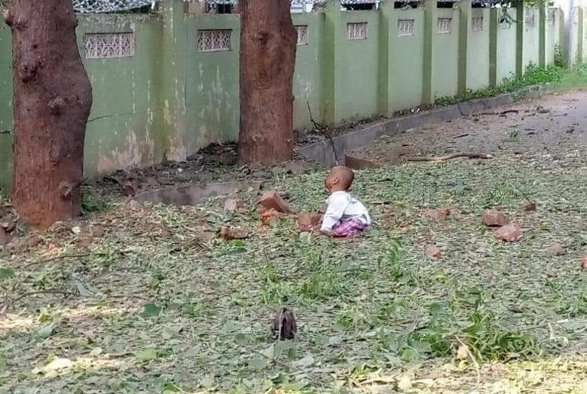 The photo spreading on social media shows a very young child who got injured by the bomb blast near the Agriculture Department in Monywa.