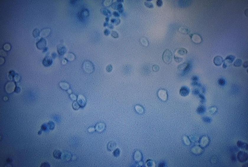 At Least 3 Cases Of Super Fungus Candida Auris Infection Detected In Singapore Since 2012 All 3 