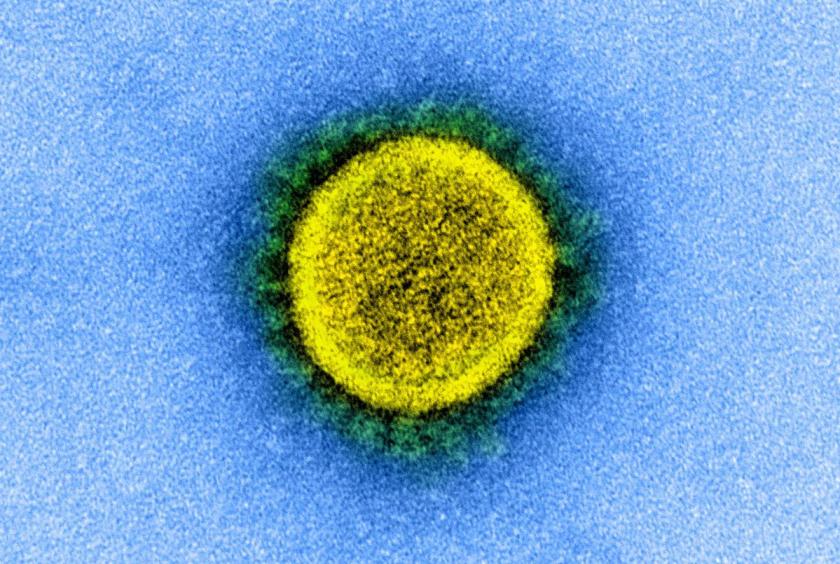 An undated transmission electron micrograph of a novel coronavirus particle, the virus which causes COVID-19, isolated from a patient. [Photo/Agencies]